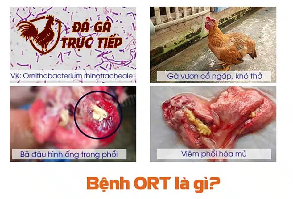 hfdx ORT Là Gì? Nguyên Nhân và Tác Nhân Gây Bệnh